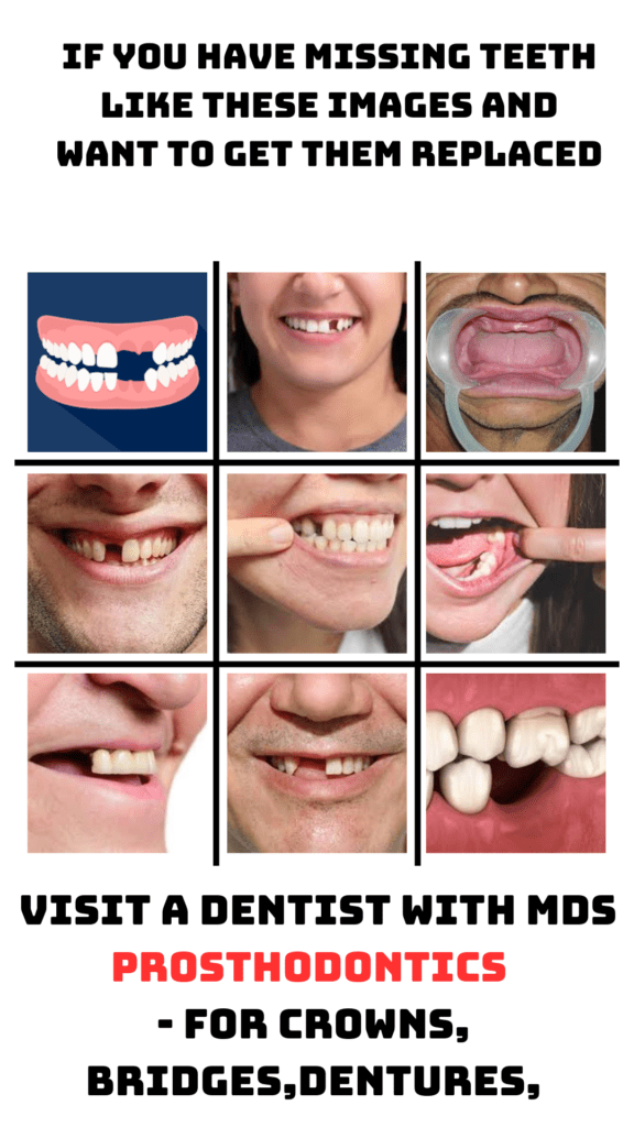 The image contains a collage of 9 pictures of oral cavity with missing teeth.The text " If you have missing teeth like these images and want to get them replaced" is written on top while the text "  visit a Dentist with MDS Prosthodontics 
- For Crowns, Bridges,Dentures" is written below the collage.