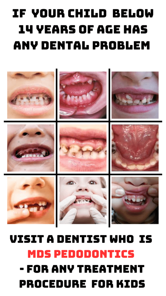 The image contains a collage of 9 pictures in the centre.The pictures are of oral cavities of children with dental problems.The text " If  your child  below 14 years of age has any dental problem " is written on top while the text " visit a Dentist who  is  mds pedodontics 
- For any treatment procedure  for kids" is written below the collage.The background is white.