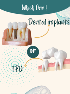 The image shows two options which can be used for replacement of missing teeth.They are dental implants and fixed partial dentures.The text " Which one Dental implant or FPD is written on the image.