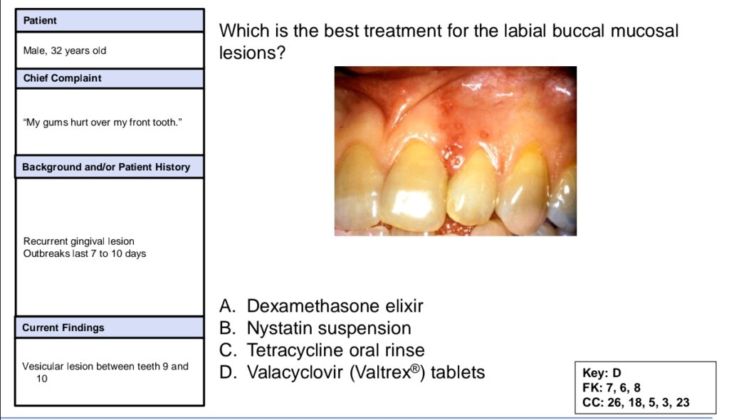 Sample Question 2 to Understand the Pattern of INBDE Exam